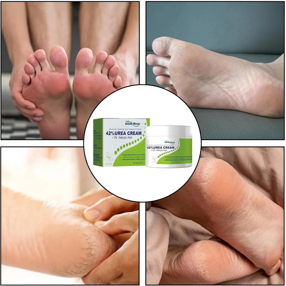 South Moon - 42% Urea Cream + 2% Salicylic Acid (Original) - Crown Cart